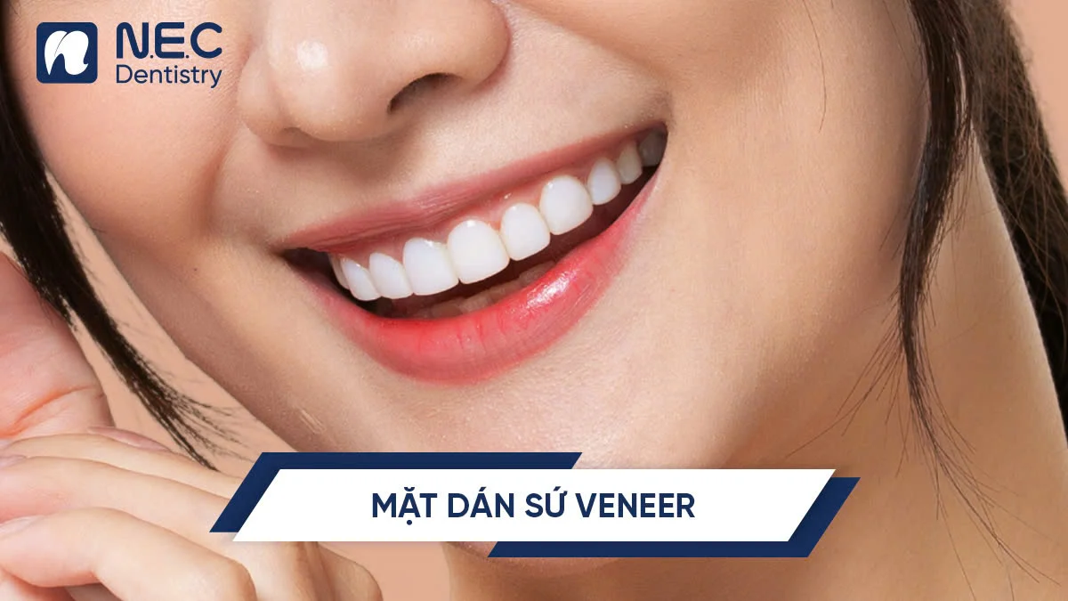 Mặt dán sứ Veneer: Giải pháp thẩm mỹ tối ưu cho nụ cười tự tin